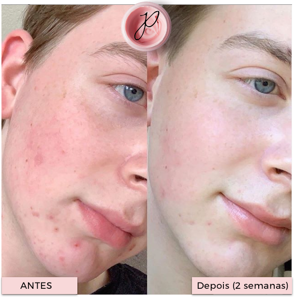 Argila PinkPerfect